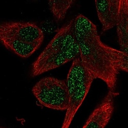 AEBP2 Antibody, Novus Biologicals:Antibodies:Primary Antibodies
